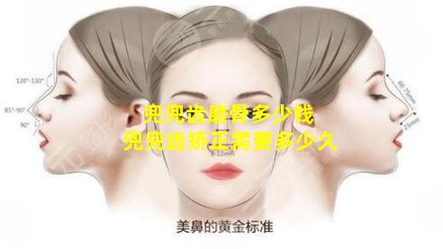 兜兜齿磨骨多少钱 兜兜齿矫正需要多少久